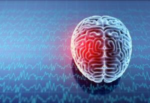 What Is a Mild Traumatic Brain Injury Under Georgia Law?