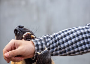 Why Hire Jamie Casino Injury Attorneys After a Dog Bite in Columbia, SC?